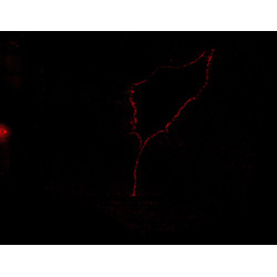 11PCW human midbrain